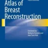 Atlas of Breast Reconstruction(Publisher PDF)