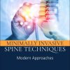 Minimally Invasive Spine Techniques