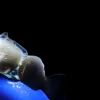 OHI-S Occlusion-driven stress-reduced direct composite (SRDC)