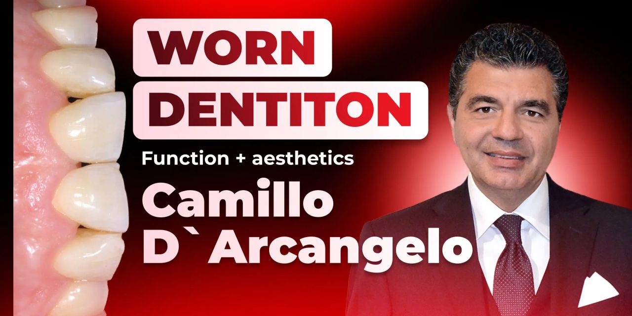 OHI-S Treatment of pathological tooth wear. Additive prosthodontics. The concept Aesthetics-Function-Posture 10 lession 19h36m