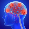 University of Miami Thinking Through Alzheimer’s