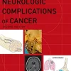 Neurologic Complications of Cancer (Contemporary Neurology Series Book 73), 2nd edition (Original PDF from Publisher)