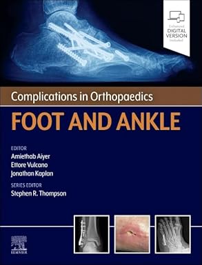 Complications in Orthopaedics: Foot and Ankle (EPUB)
