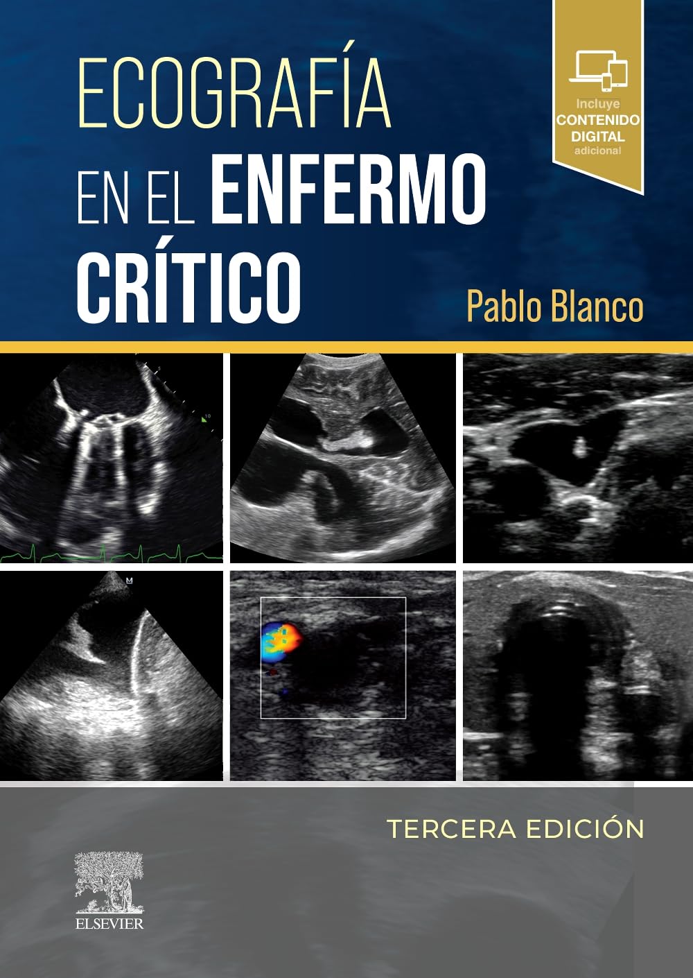 Ecografía en el enfermo crítico, 3rd Edition (Original PDF from Publisher)