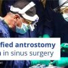Osteocom - Simplified Antrostomy Design in Sinus Surgery - Tiziano Testori