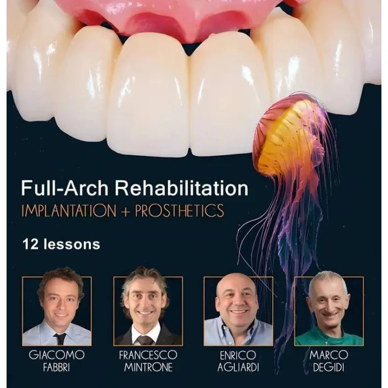 OHI-S Full-Arch Rehabilitation, Implantation and Prosthetics
