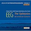 Atlas of electroencephalography