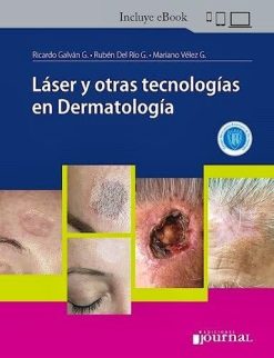 Láser y otras tecnologías en Dermatología (Original PDF from Publisher)