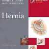 Master Techniques in Surgery: Hernia, 2nd Edition (EPUB)