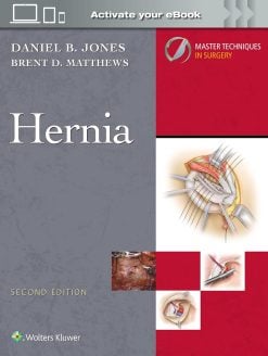 Master Techniques in Surgery: Hernia, 2nd Edition (EPUB)