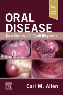 Oral Disease: Case Studies of Difficult Diagnoses (EPUB)