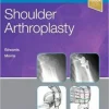 Shoulder Arthroplasty, 2e (Original PDF from Publisher)