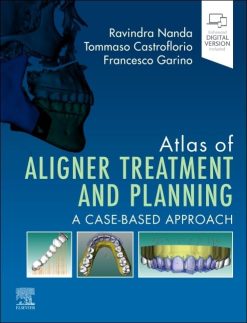 Atlas of Aligner Treatment and Planning: A Case-Based Approach (Original PDF from Publisher)