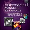 Cardiovascular Magnetic Resonance