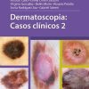 Dermatoscopia: Casos clinicos 2 (Scanned PDF)