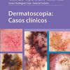 Dermatoscopia: Casos clínicos (Spanish Edition) (Scanned PDF)