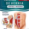 El Arte de la Cirugía de Hernia, Ventral e Incisional (Spanish Edition) (Scanned PDF)