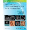 First Trimester Ultrasound Diagnosis of Fetal Abnormalities, 2nd edition (EPUB)