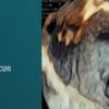 Harvard Boston 3D Echo Workshop 2026
