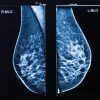 Oakstone UCSF Breast Imaging 2026
