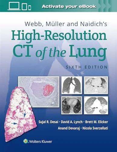 Webb, Müller and Naidich’s High-Resolution CT of the Lung, 6th edition (Original PDF from Publisher)